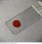 microscope_slide_with_blood_sample_m530561.jpg